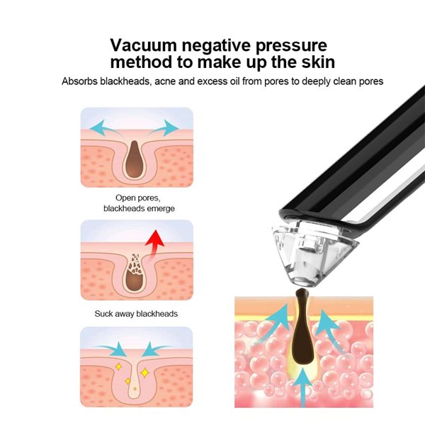 Rechargeable Hot & Cold Compress Skin Care Vacuum Suction Pimple Blackhead Remover