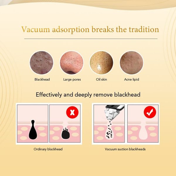 Rechargeable Hot & Cold Compress Skin Care Vacuum Suction Pimple Blackhead Remover