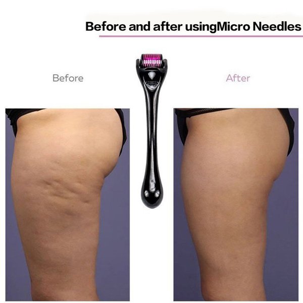 Best 540 Titanium Microneedle Derma Roller 0.5mm Black/Purple (1 piece)
