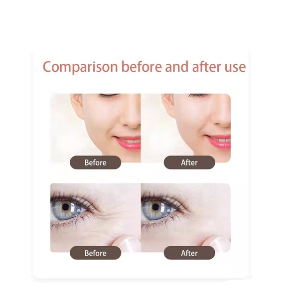 EMS Rechargeable Eye Massager Beauty Device