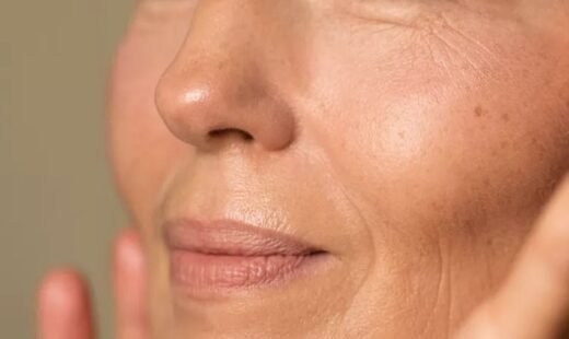 Anti Aging