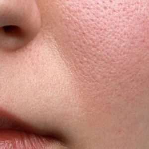 Pores