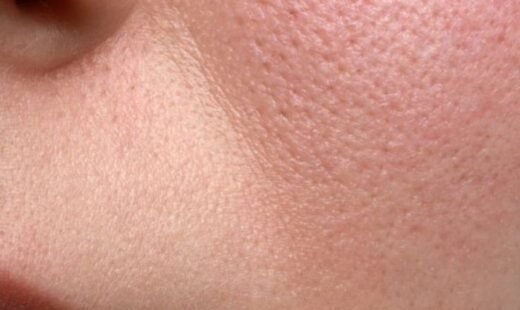 Pores