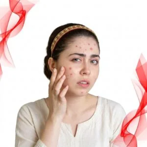 Fungal acne safe
